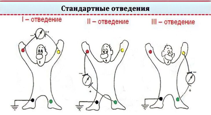 Как общаться в проприетарном зоопарке или проблема совместимости медицинских устройств