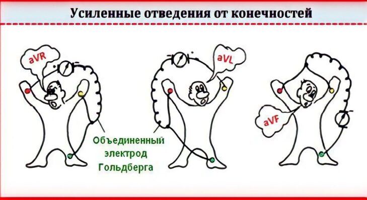 Как общаться в проприетарном зоопарке или проблема совместимости медицинских устройств