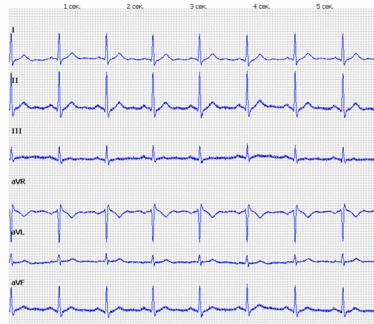 Как общаться в проприетарном зоопарке или проблема совместимости медицинских устройств