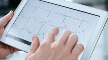 Алгоритм распознавания ЭКГ-артефактов